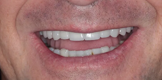Sorriso renovado