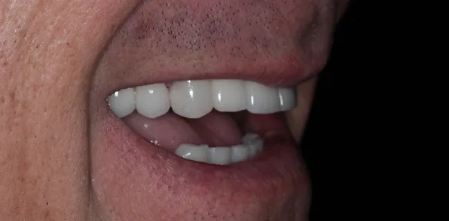 Sorriso renovado
