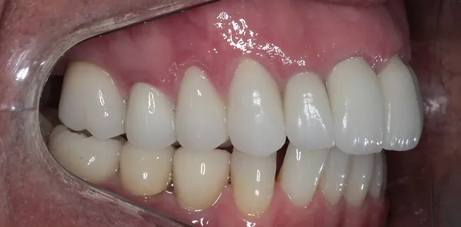 Sorriso renovado