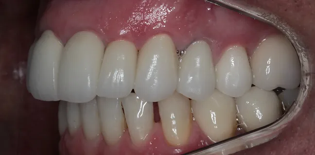 Sorriso renovado