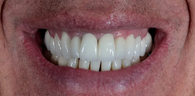 Sorriso renovado