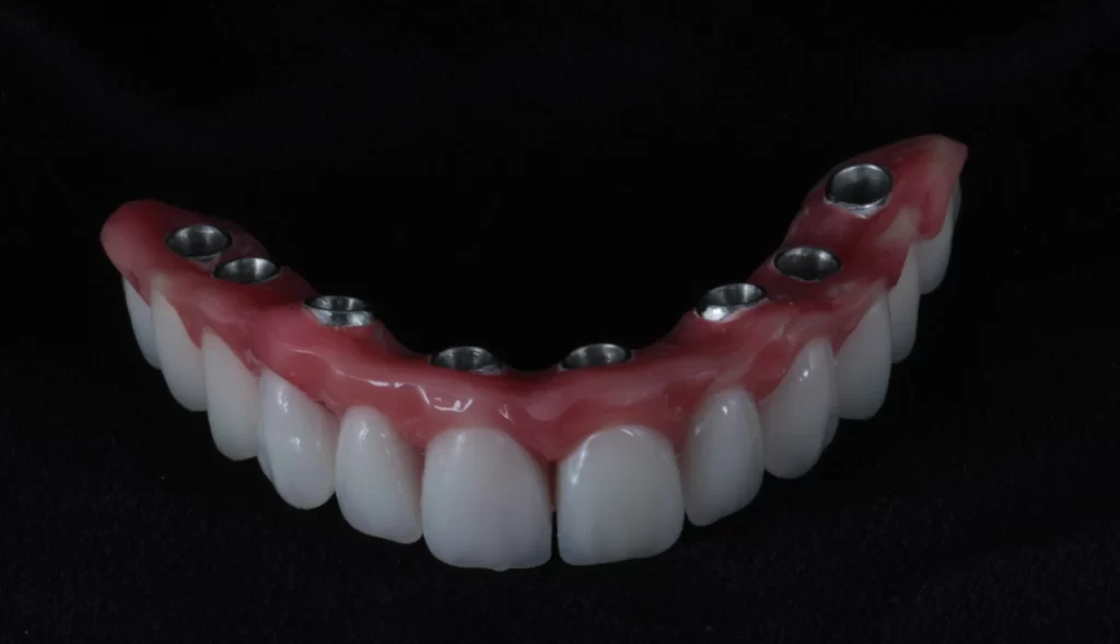 Prótese protocolo - realizada após 48h da cirurgia